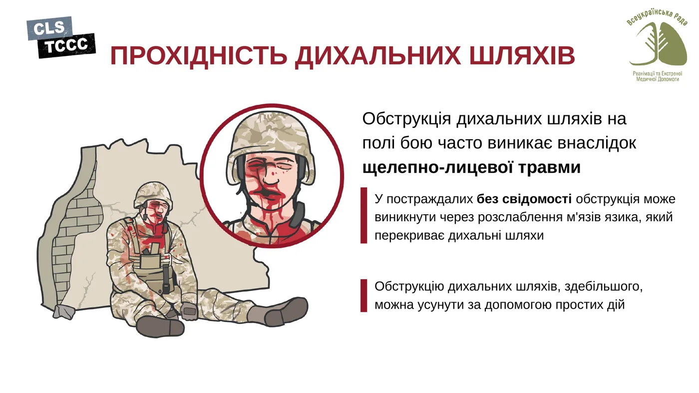 Прохідність дихальних шляхів: базова ідея