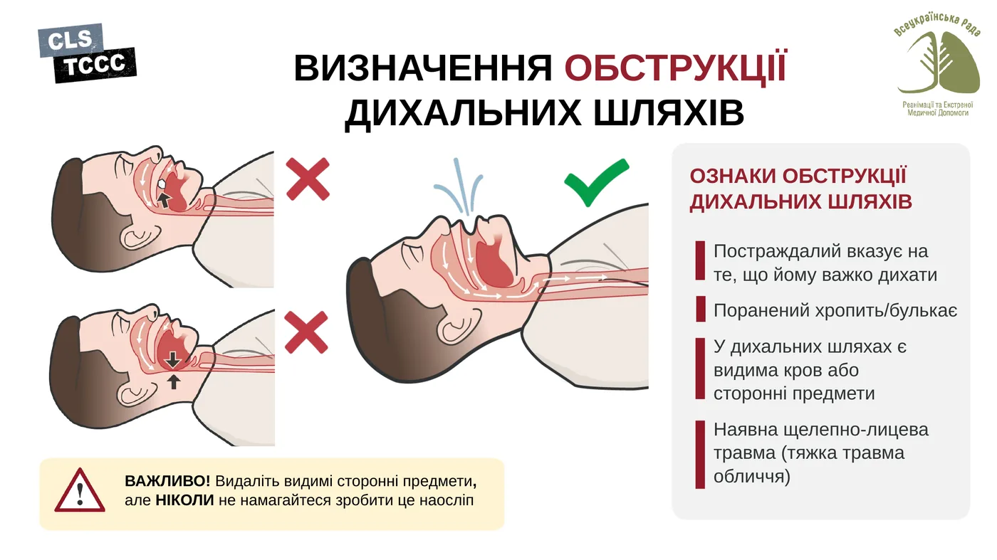 Ознаки обструкції дихальних шляхів і що робити